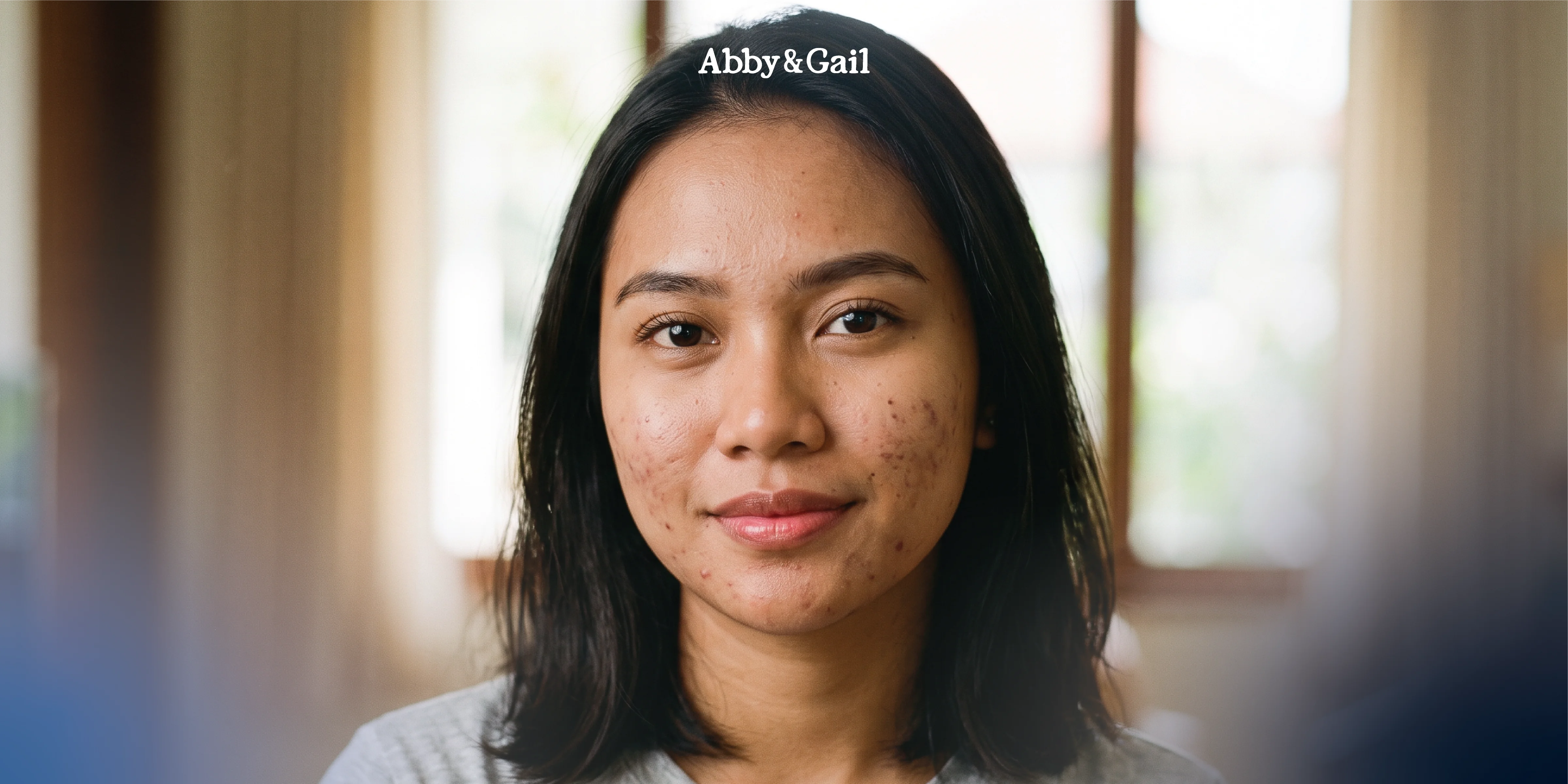 Abby and Gail - Beauty Online Store Terlengkap - kandungan skincare untuk jerawat.webp